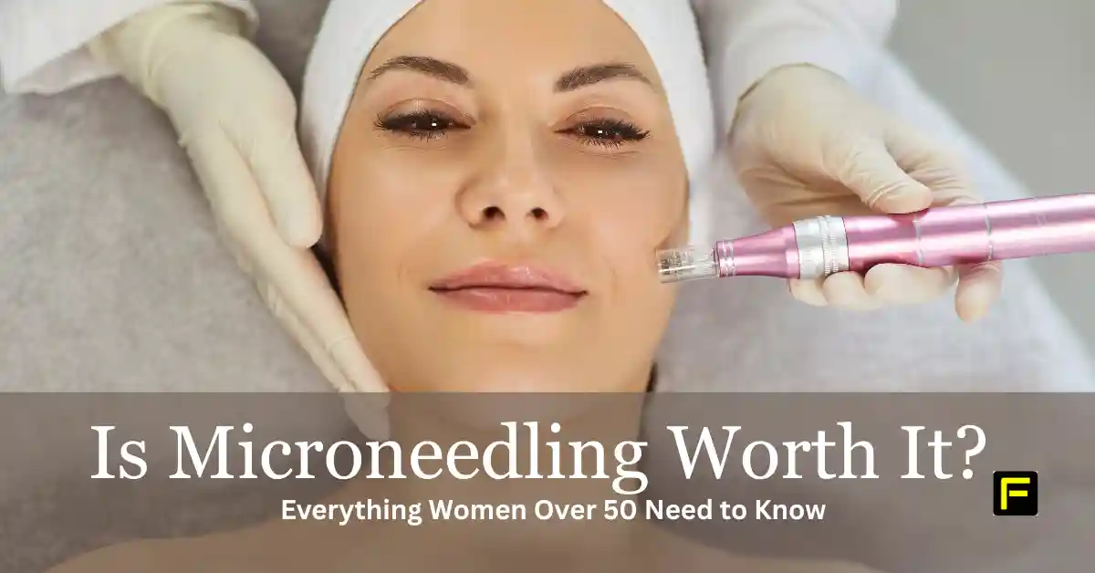 Home 19 Is Microneedling Worth It? Featured image.